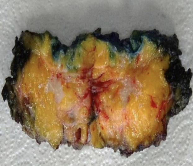 Description of the image
